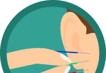 acupuncture, ear, needles-3654316.jpg