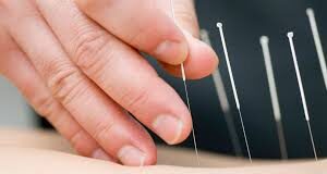 中巴醫療團隊宣/溫馨提醒